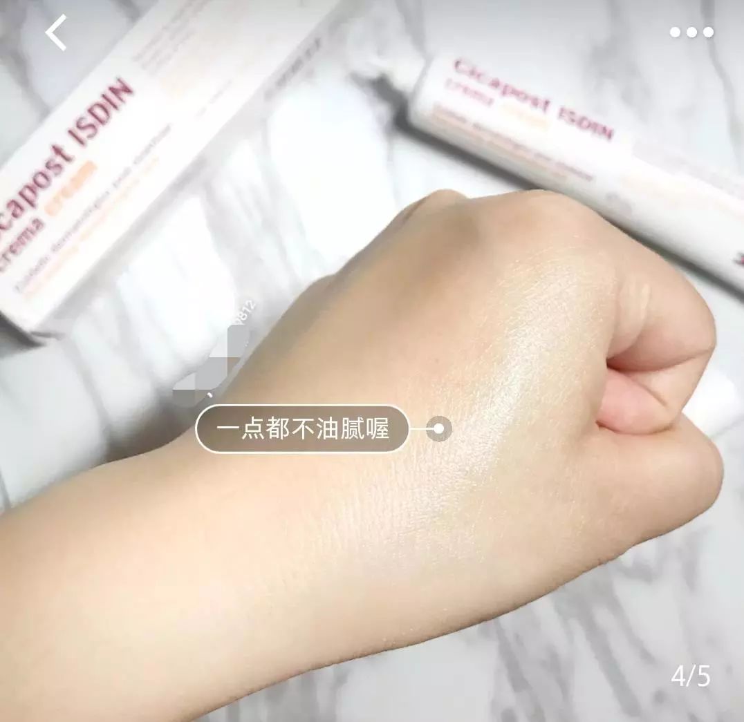 疤痕体质如何去痘印和烫伤印,烫伤色素疤痕修复的最新方法