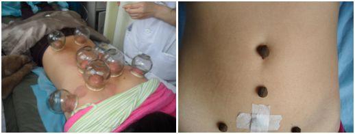 科室介绍┃甘肃省中医院妇产科