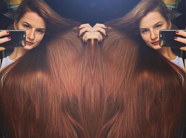 从“秃头症”到长发公主，听起来有点不可思议，但这是现实