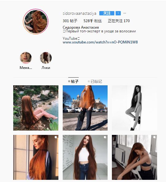 从“秃头症”到长发公主，听起来有点不可思议，但这是现实