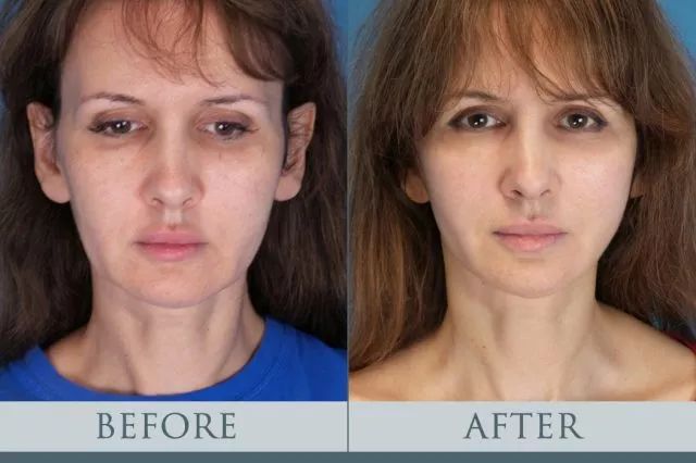 从“秃头症”到长发公主，听起来有点不可思议，但这是现实