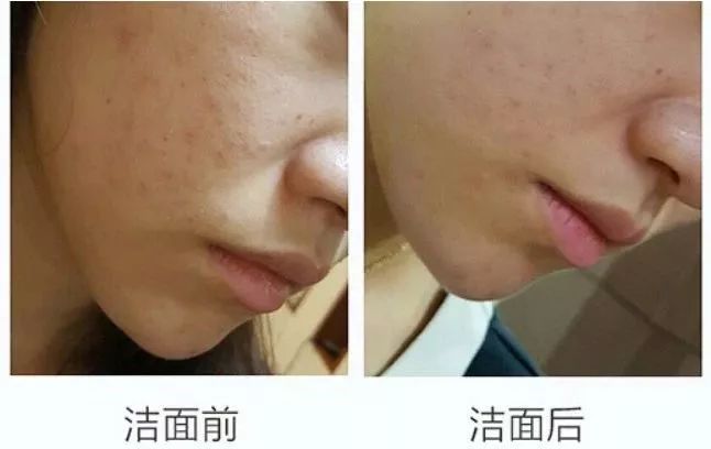 luna洁面仪选哪款,luna洁面仪用哪一款