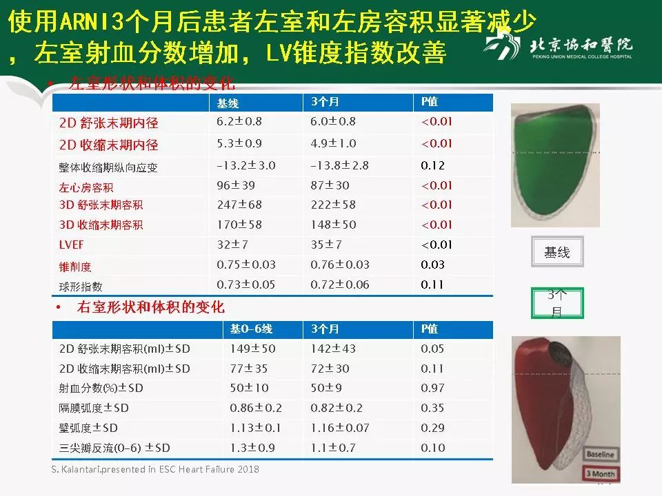 方理刚医生怎么样,心力衰竭诊断与治疗最新进展