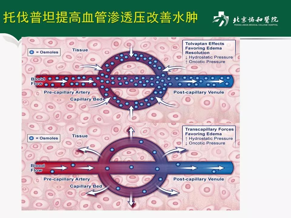 方理刚医生怎么样,心力衰竭诊断与治疗最新进展