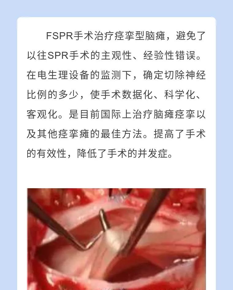 江西省脑瘫康复中心,四川八一康复中心脑瘫手术