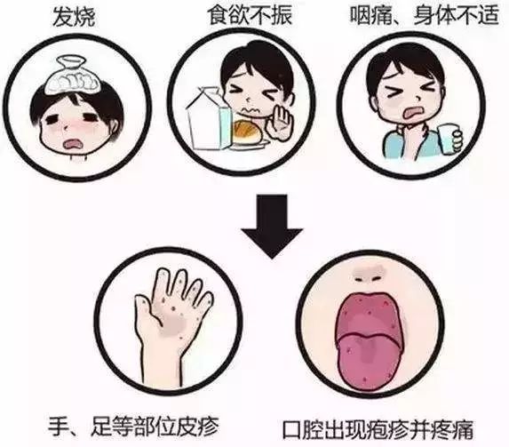 手足口病的介绍,手足口病其实不可怕