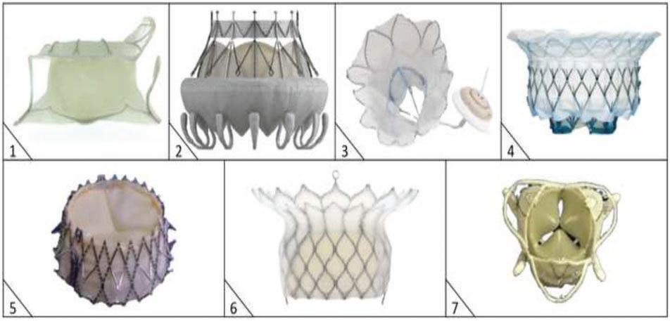 经导管瓣膜修复术费用,经导管介入治疗先天性心脏病