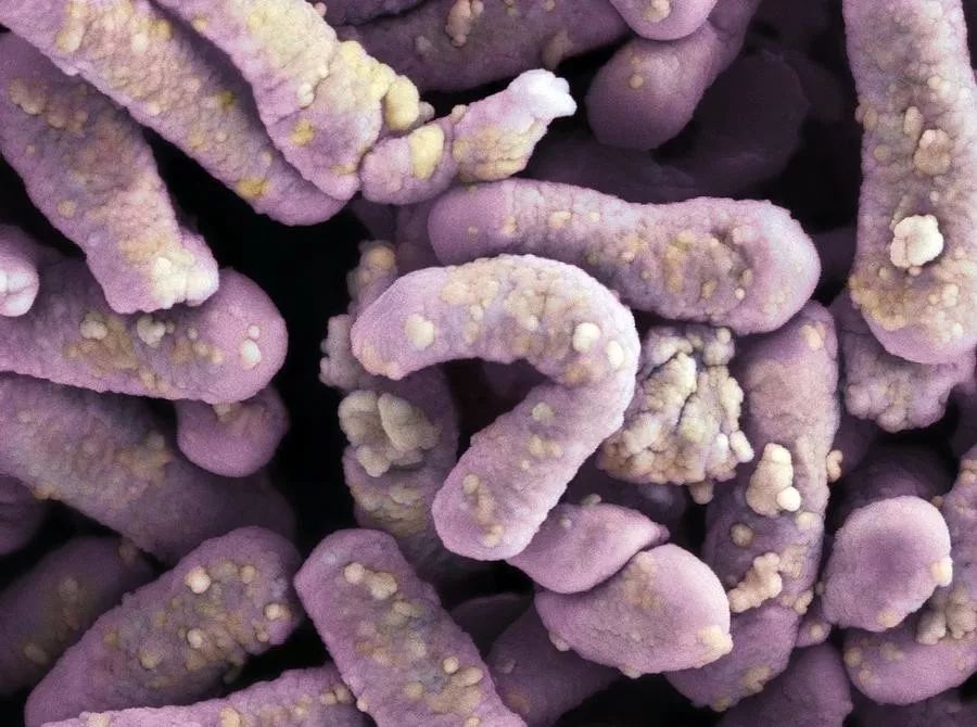 10种最可怕的细菌,人体有多少种有益细菌