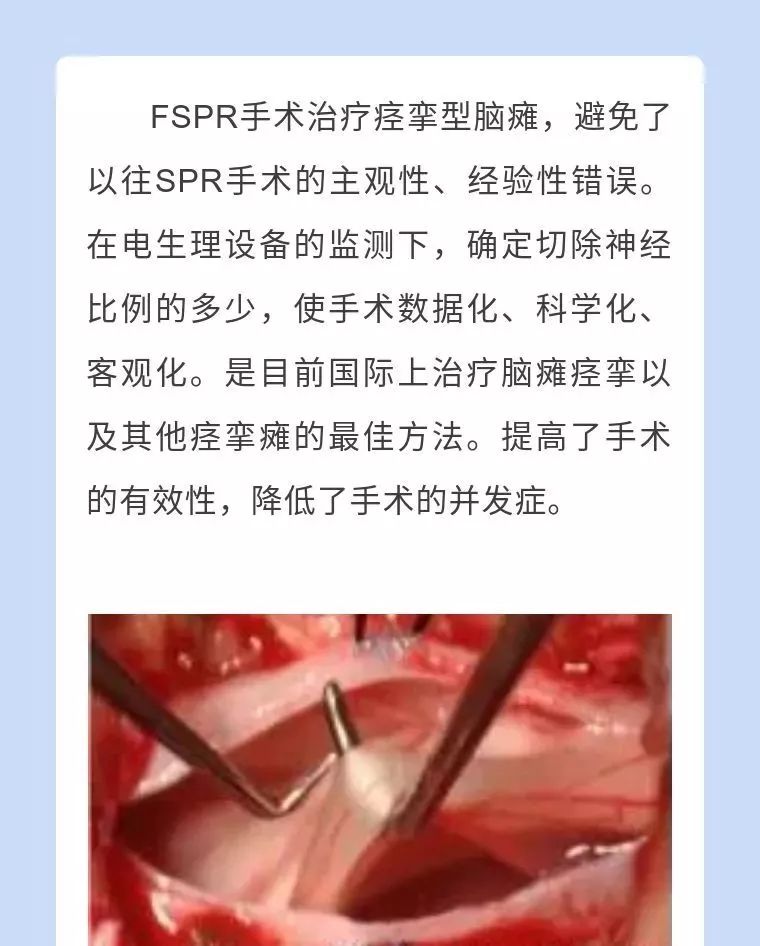 四川省八一康复中心康复科,四川脑瘫康复方法