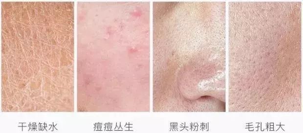 一洗就白的洗面奶火山泥,火山泥洗面奶真的能变白吗