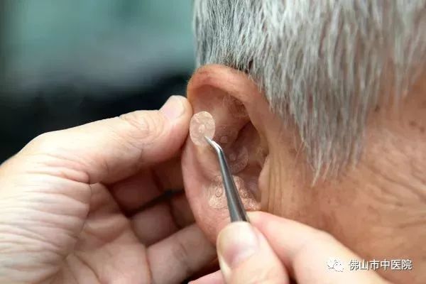 耳穴健康养生操,耳朵的养生知识与方法