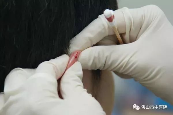 耳穴健康养生操,耳朵的养生知识与方法