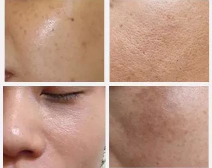 张嘉倪同款月光宝盒精华液,张嘉倪给人涂保湿美白精华液