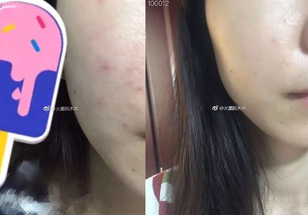 张嘉倪同款月光宝盒精华液,张嘉倪给人涂保湿美白精华液