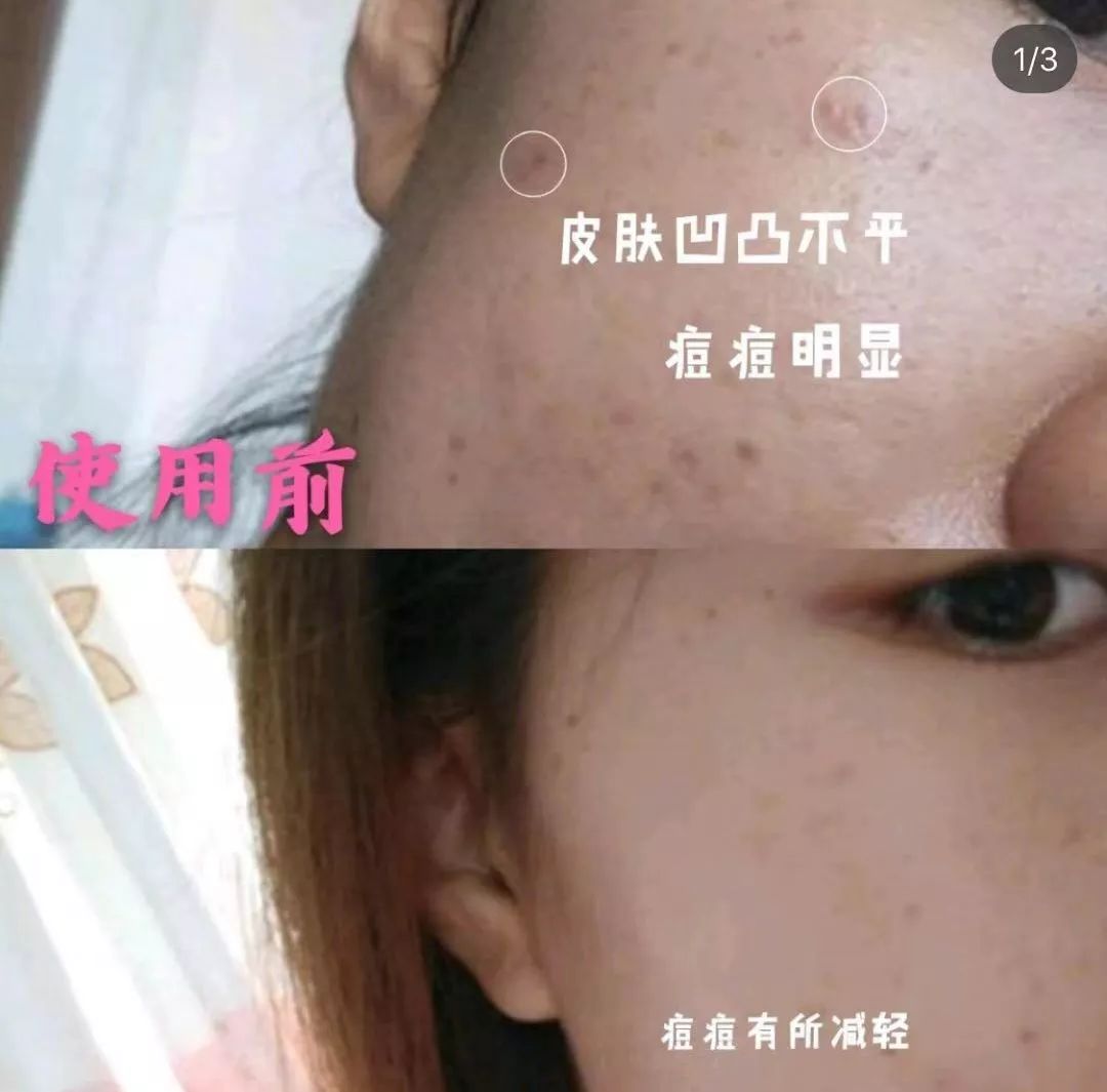 张嘉倪同款月光宝盒精华液,张嘉倪给人涂保湿美白精华液