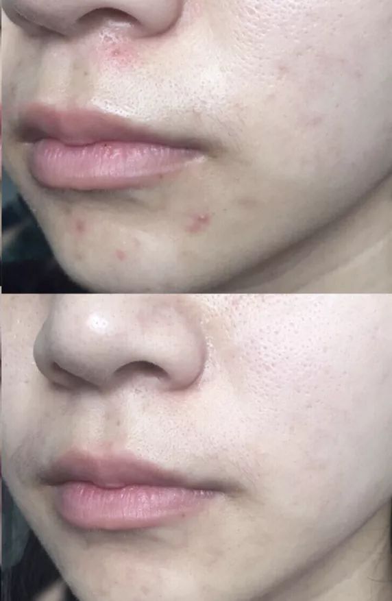 护肤小红书都在推荐的安瓶面膜,护肤补水推荐小红书