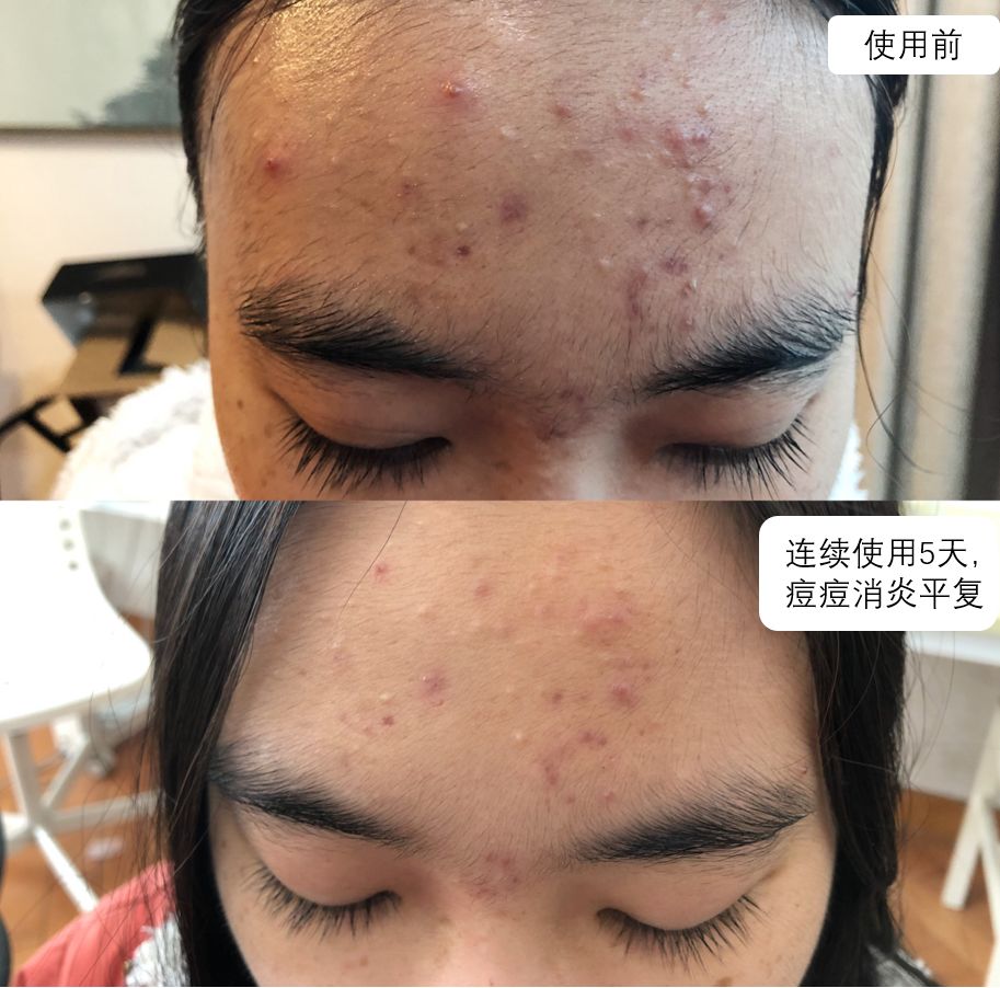 农科院面膜,农科院研发的面膜