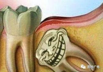 上面智齿磨下牙床肿了怎么办,上火智齿旁边的肉肿了怎么办