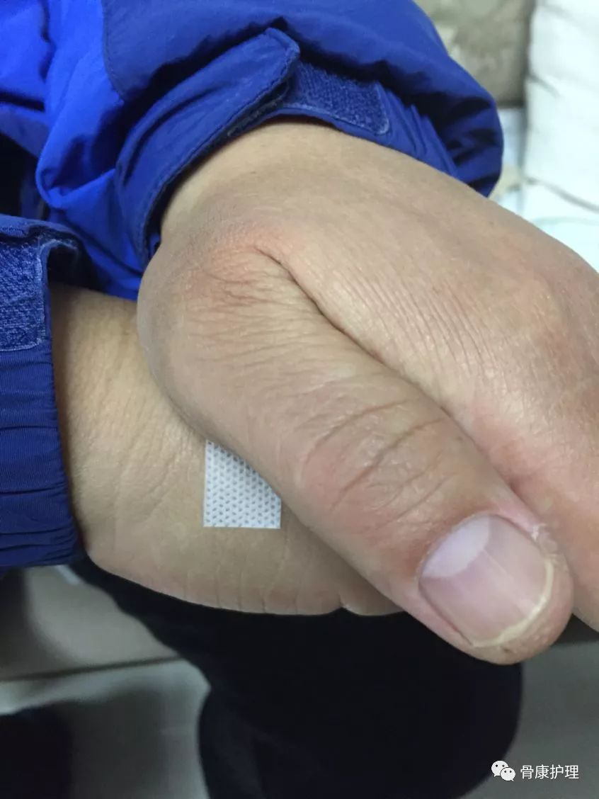 打吊瓶手青了怎么迅速消除,打吊瓶手青了怎么消除