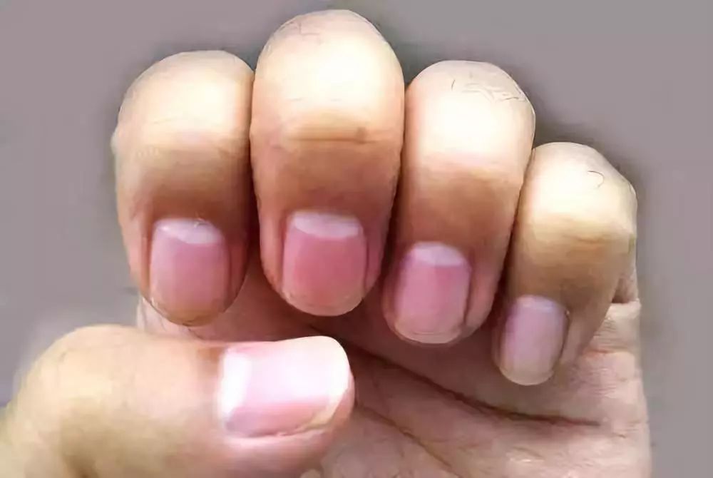 中医鬼才倪海厦：中医对于健康的判断准则