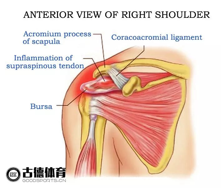 冈上肌放松的正确方法,冈上肌按摩手法