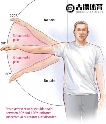 冈上肌放松的正确方法,冈上肌按摩手法