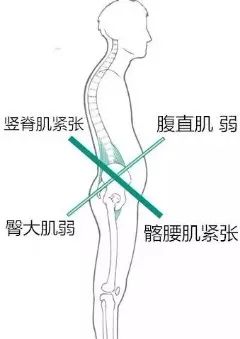 这款美臀神器这么“神”吗？