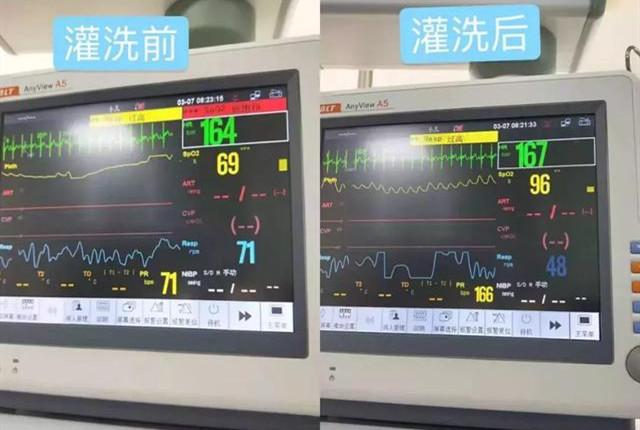 信阳市儿童中心医院,信阳市中心医院儿童重症监护病区