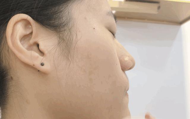 美容院的美容仪器需要投资多少钱,美容院哪些项目值得做仪器