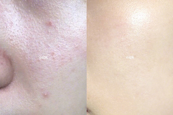 涂抹面膜测评小红书,小红书科颜氏配套面膜