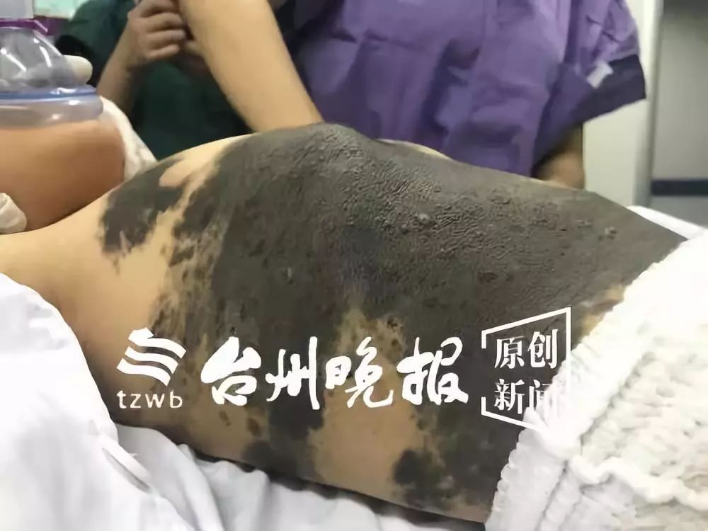 可怜的小孩身患怪病,可怜小孩得怪病