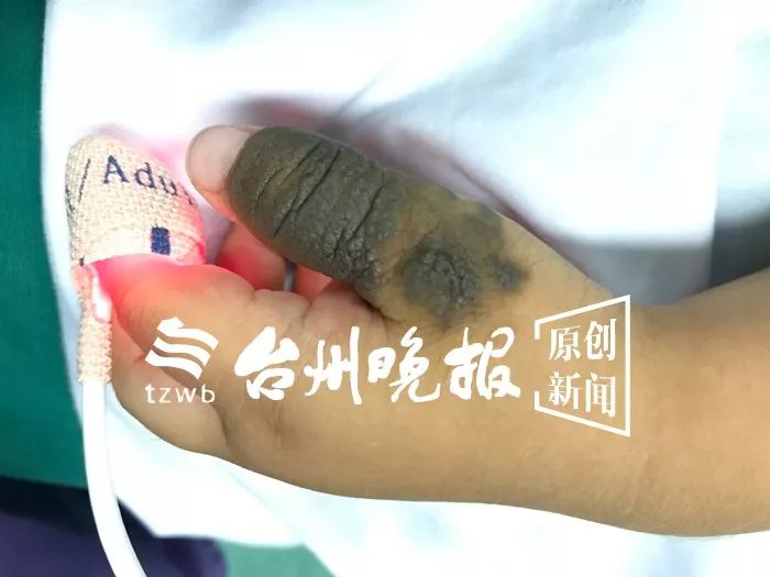 可怜的小孩身患怪病,可怜小孩得怪病