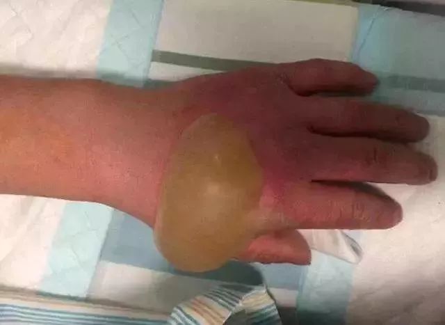 315曝光的食品有哪些危害人体,2022央视315黑榜食品全名单辣条