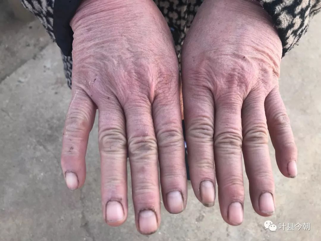 【追忆刘随伸】“他答应俺妈的事儿，一件都没做”