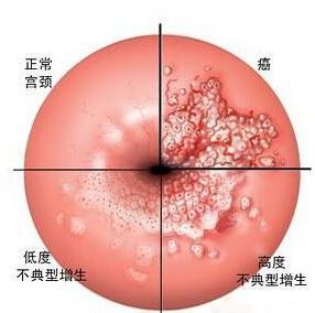 妊娠期检查一般几个阶段,妊娠期检查有哪些