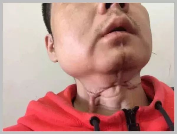 被国家点名的疯狂槟榔：嘴上的癌，说不出的痛