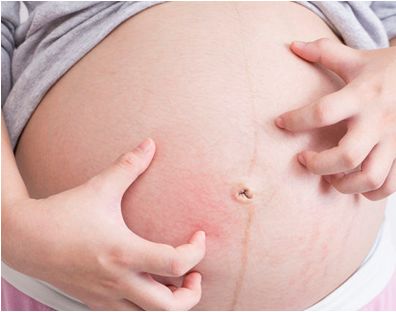 【药我说】孕期皮肤痒痒痒，能用什么药？