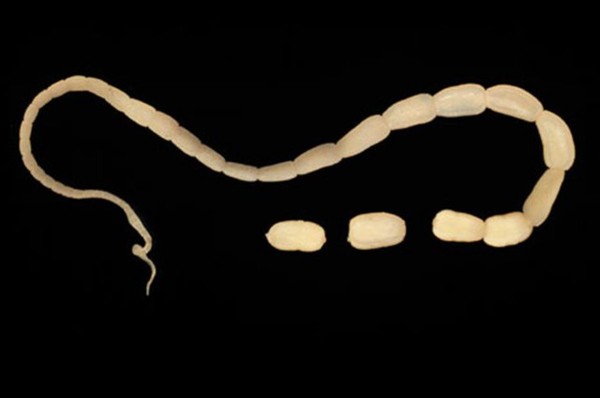 小朋友拉屎有小白虫是怎么回事,小孩大便里有细小的虫是什么原因