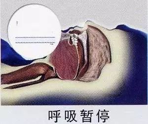 国际睡眠日恰遇春分,春分遇上睡眠时间