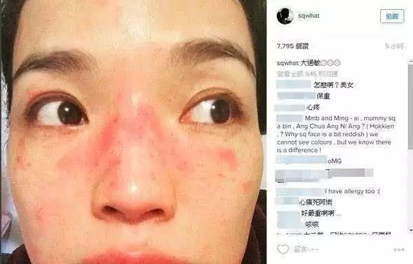 痘印红血丝修复护肤品平价,痘印泛红团购