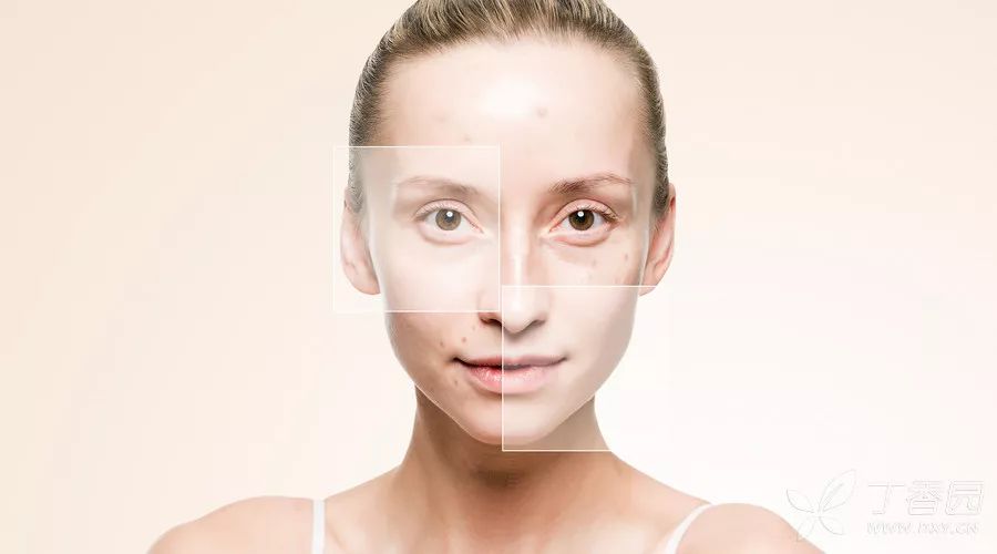 痘印红血丝修复护肤品平价,痘印泛红团购