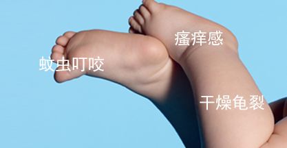 痘印红血丝修复护肤品平价,痘印泛红团购