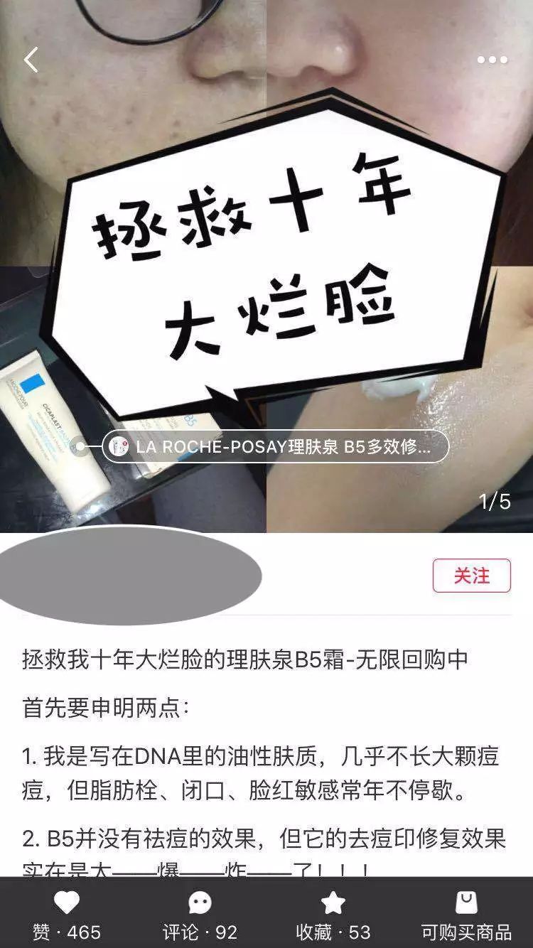 痘印红血丝修复护肤品平价,痘印泛红团购