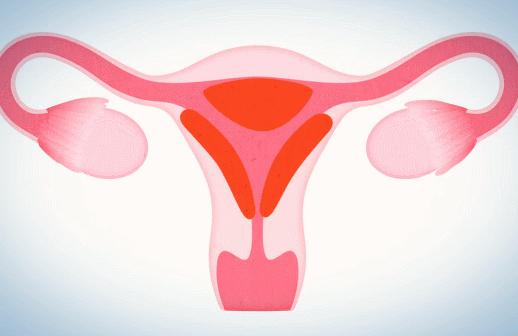 鍏充簬鏈堢粡琚瑙嗙殑妗堜緥,鏈堢粡缇炶颈