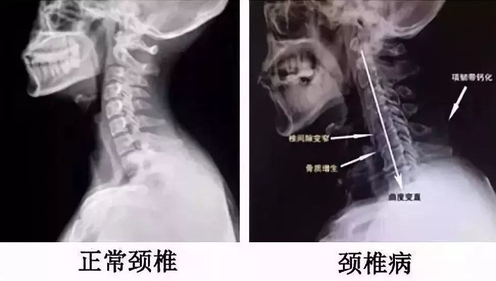 提高睡眠质量护颈椎枕头,枕头中的奢侈品