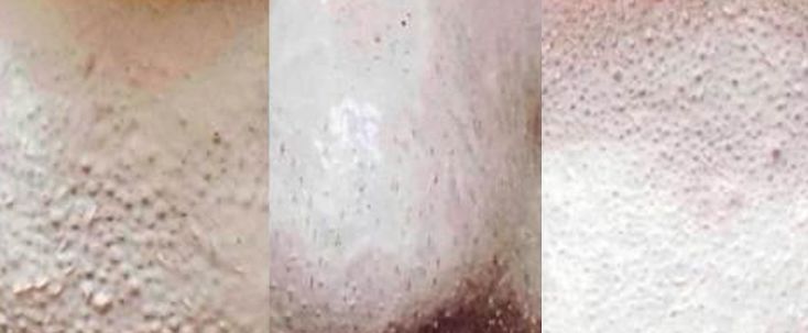 用了几年的火山泥一洗白,用火山泥洗澡