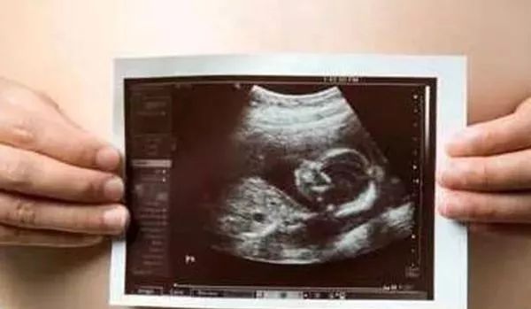 医院超声科新引进设备宣传,营口市中心医院分院彩超室