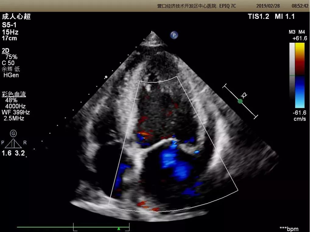 医院超声科新引进设备宣传,营口市中心医院分院彩超室