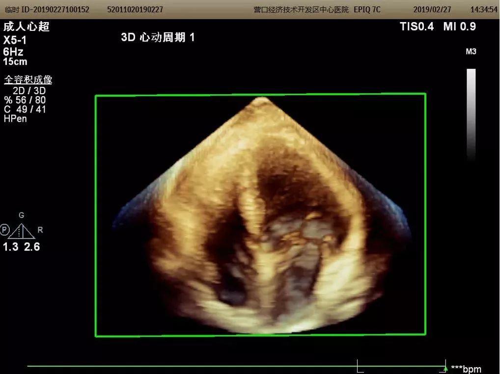 医院超声科新引进设备宣传,营口市中心医院分院彩超室