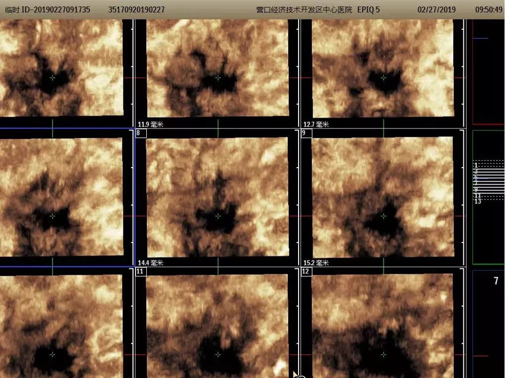 医院超声科新引进设备宣传,营口市中心医院分院彩超室